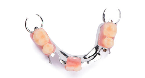 Lower,Metal,Denture,On,A,White,Background