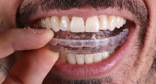 Muscle,Relaxant,Device,For,Bruxism