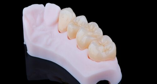 High-quality,Naturally,Dental,Single,Crowns,Made,Of,Zirconium,For,Fixation