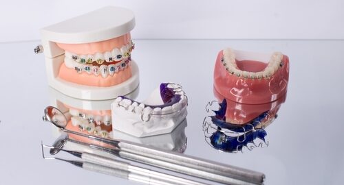Dentist,With,Orthodontic,Tooth,Model,And,Bracket,Or,Brace.,Clean Dentist,With,Orthodontic,Tooth,Model,And,Bracket,Or,Brace.,Clean