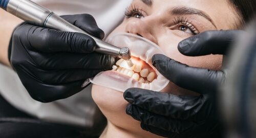 Dentist,Making,Professional,Teeth,Cleaning,And,Polishing,Female,Young,Patient Dentist,Making,Professional,Teeth,Cleaning,And,Polishing,Female,Young,Patient